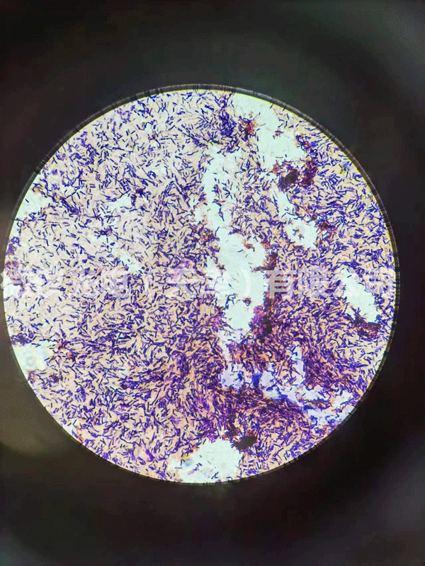 用麻豆影音在线观看光電麻豆成人在线观看進行芽孢及革蘭氏染色杆菌的觀察